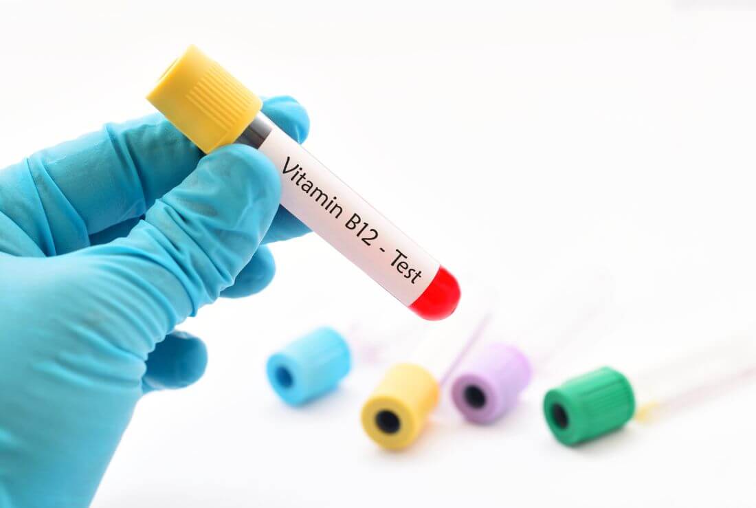 vitamina b12 quale scegliere